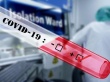В Саратовской области подтверждены уже почти две тысячи случаев коронавируса